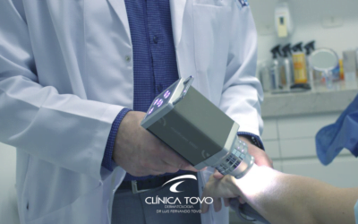 Dermatoscopia Digital e Mapeamento Corporal