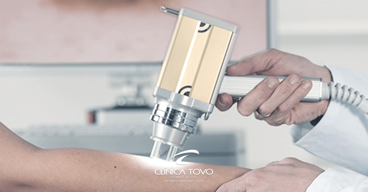 dermatologista x inteligência artficial