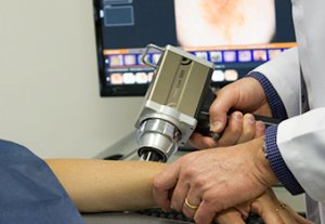 MAPEAMENTO CORPORAL DE NEVOS | clinica tovo | dr tovo | luis fernando tovo