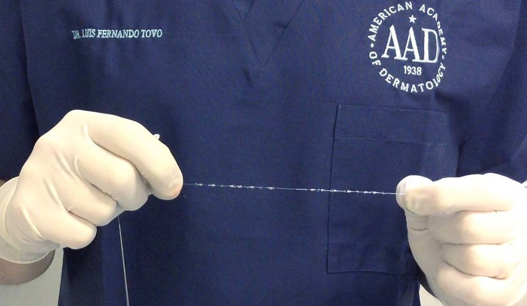 Preenchedores Cutâneos e Fios de Sustentação – Quais são as Diferenças Entre Eles? – Dr. Tovo