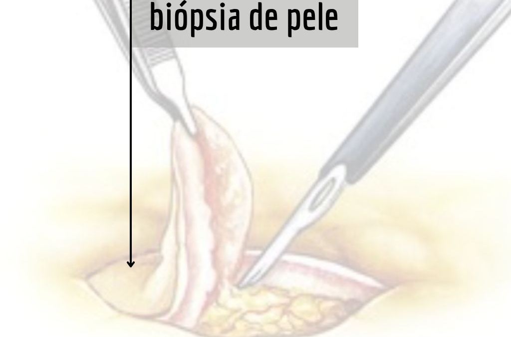 biopsia de pele sirio libanes tovo